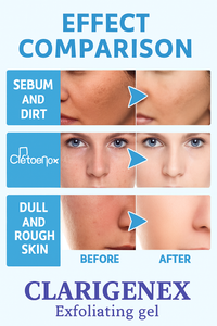 Clarigenex Exfoliating Dark Spot Treatment Oil